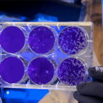 immunoterapia-contro-i-tumori:-le-applicazioni-di-una-scoperta-da-nobel
