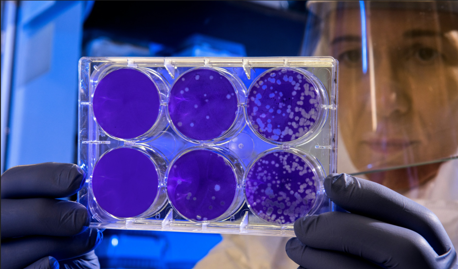 immunoterapia-contro-i-tumori:-le-applicazioni-di-una-scoperta-da-nobel