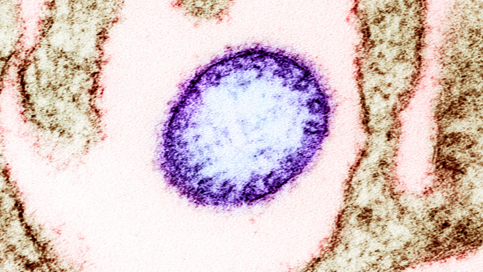 nipah,-in-europa-il-virus-non-spaventa.-ma-il-contesto-si