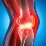 cartilagine:-quali-alimenti-la-supportano-davvero-(e-curiosita-storiche)