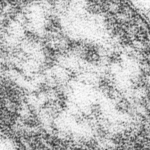 morbillo,-un-ritorno-annunciato:-perche-l’eradicazione-si-allontana