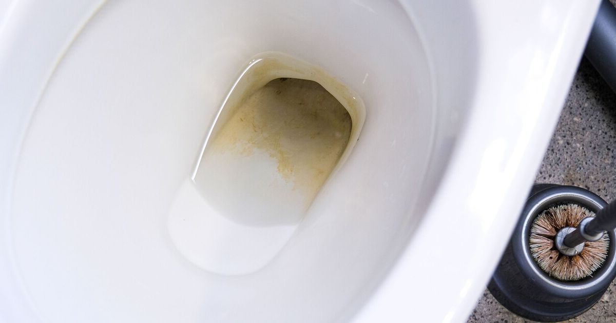 come-rimuovere-il-calcare-vecchio-e-incrostato-dal-wc-in-modo-naturale