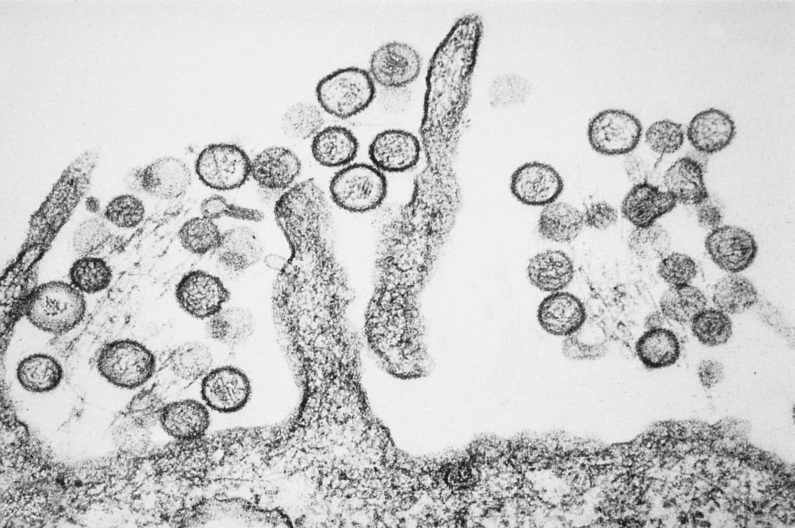 hantavirus-e-piano-pandemico:-siamo-davvero-pronti?
