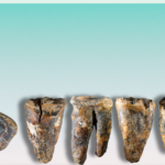 neanderthal-dal-dentista?