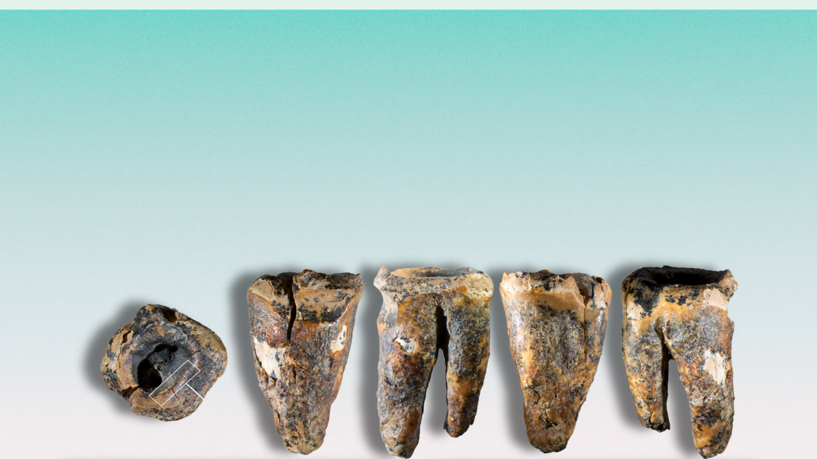 neanderthal-dal-dentista?