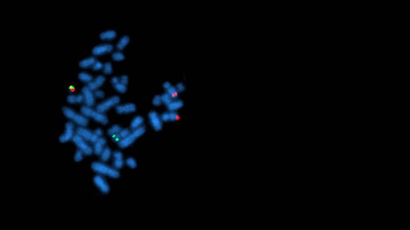 philadelphia,-quando-un-cromosoma-diventa-un-test
